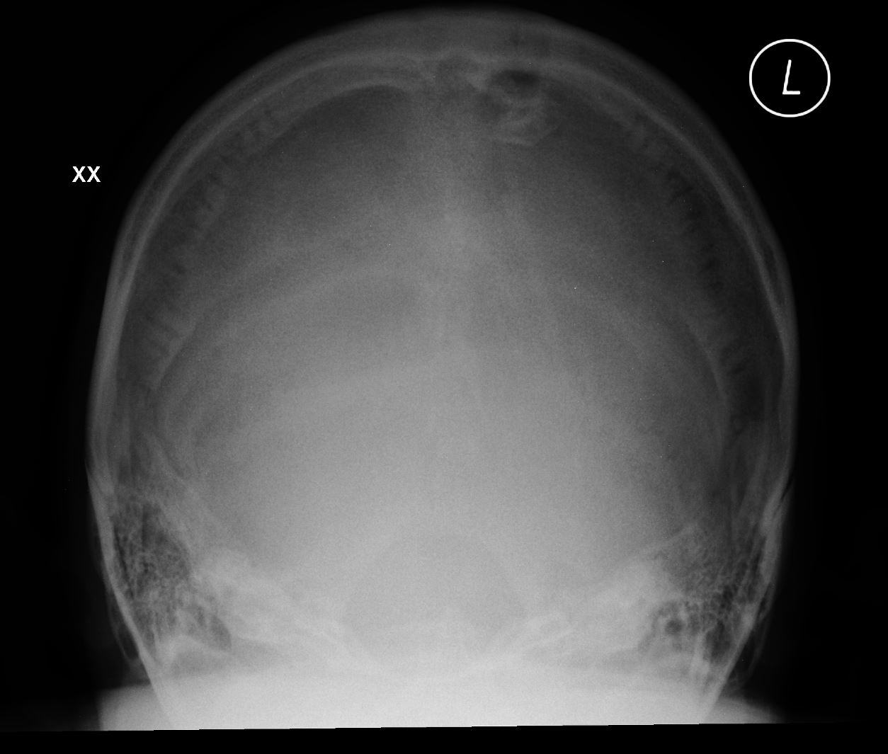 Case 14